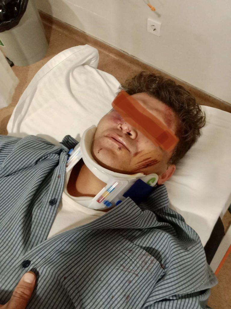 DahiliyeDoktoru's tweet photo. Torbalı ASM’de görev yapan aile hekimi meslektaşım 1 ay önce verdiği beyaz koddan dolayı; 3 kişi tarafından bugün takip edilerek, pusuya düşürülüp sopalarla darp edildi. Yazıklar olsun… #SağlıktaŞiddetSonaErsin https://t.co/qLUUaCtTMr