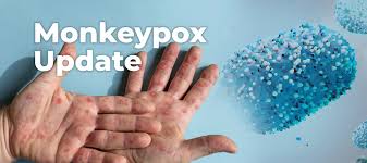 HOT off the Presses &amp; free for 30 days:

Monkeypox Virus Outbreak 2022: Key Epidemiologic, Clinical, Diagnostic, and Prevention Considerations

Read it at: //bit.ly/JANAC_MPX

Written by incredible <a href="/ANACnurses/">Association of Nurses in AIDS Care</a> #Nurses :

<a href="/jasonfarleyJHU/">Jason Farley, PhD, MPH, NP, FAAN, FAANP</a> <a href="/jkwong_np/">Jeffrey Kwong</a> <a href="/AlannaBergman2/">Alanna Bergman</a> <a href="/AAN_Nursing/">American Academy of Nursing</a>