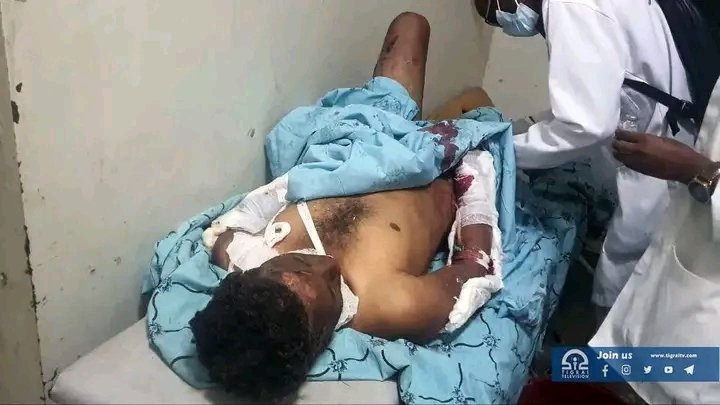 mahi_tigray's tweet photo. #Tigray 6 Dead, Over 80 Wounded in Today's Attack on #Dengolat #TigrayUnderAttack @UN_HRC @SFRCdems @SenateForeign @HouseForeign @UKParliament @EU_Commission @Europarl_EN @JosepBorrellF @USUN @UKUN_NewYork @franceonu @irishmissionun @NorwayMFA @AlMissionUN @DanishMFA @SweMFA https://t.co/ThBvxsOFOu