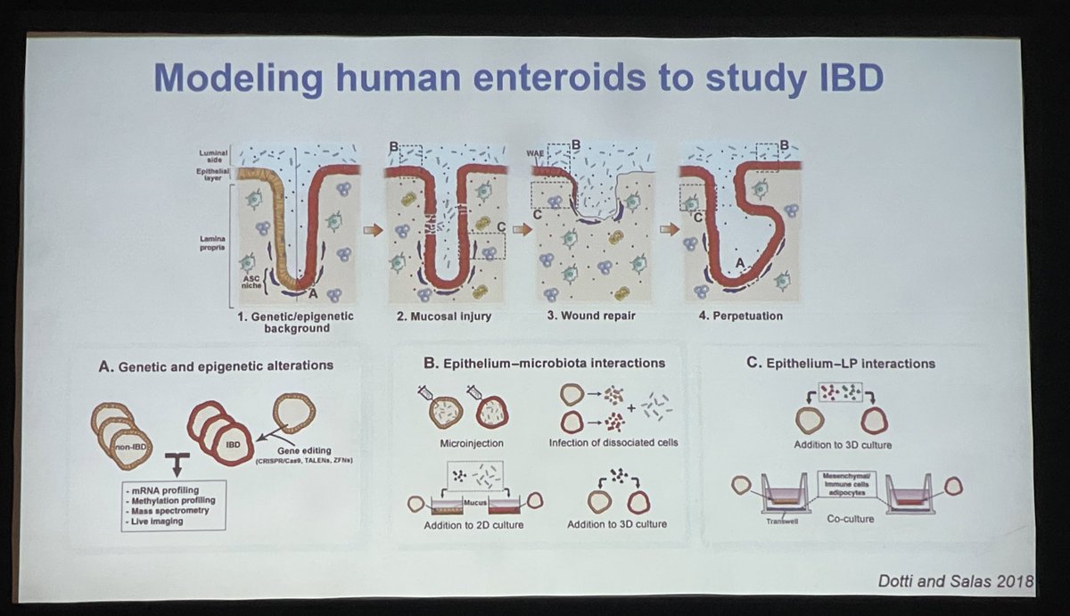 GuiRamosMD's tweet photo. AGA James W. Freston Mtg, @ZachosLab shows organoids from UC pts retain tissue signature being great tools to study cellular interactions in the inflamed intestine. Cross talk with the epithelium directs immune cell function, a lot to uncover! #Freston2022 @AmerGastroAssn https://t.co/TDZZ1IIDLR