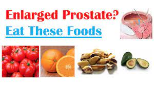 50Plushealths's tweet photo. #ProstateHealth - The #ProstateDiet https://t.co/9hSyW70WjF https://t.co/tCylZ44mmQ