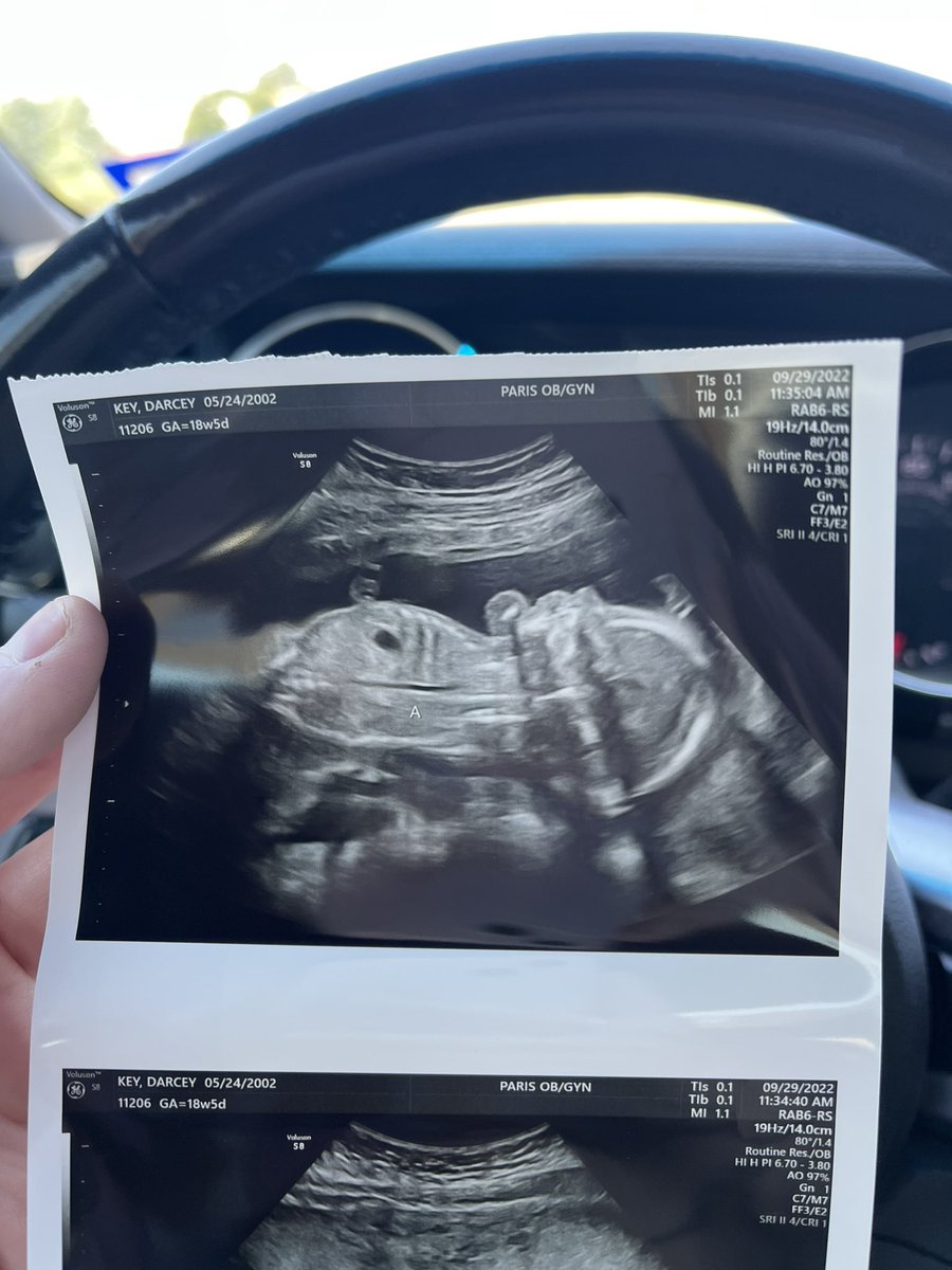 darcey_key's tweet photo. My Sweet Girls🥰❤�� #twinmom https://t.co/ntn97j1SDD