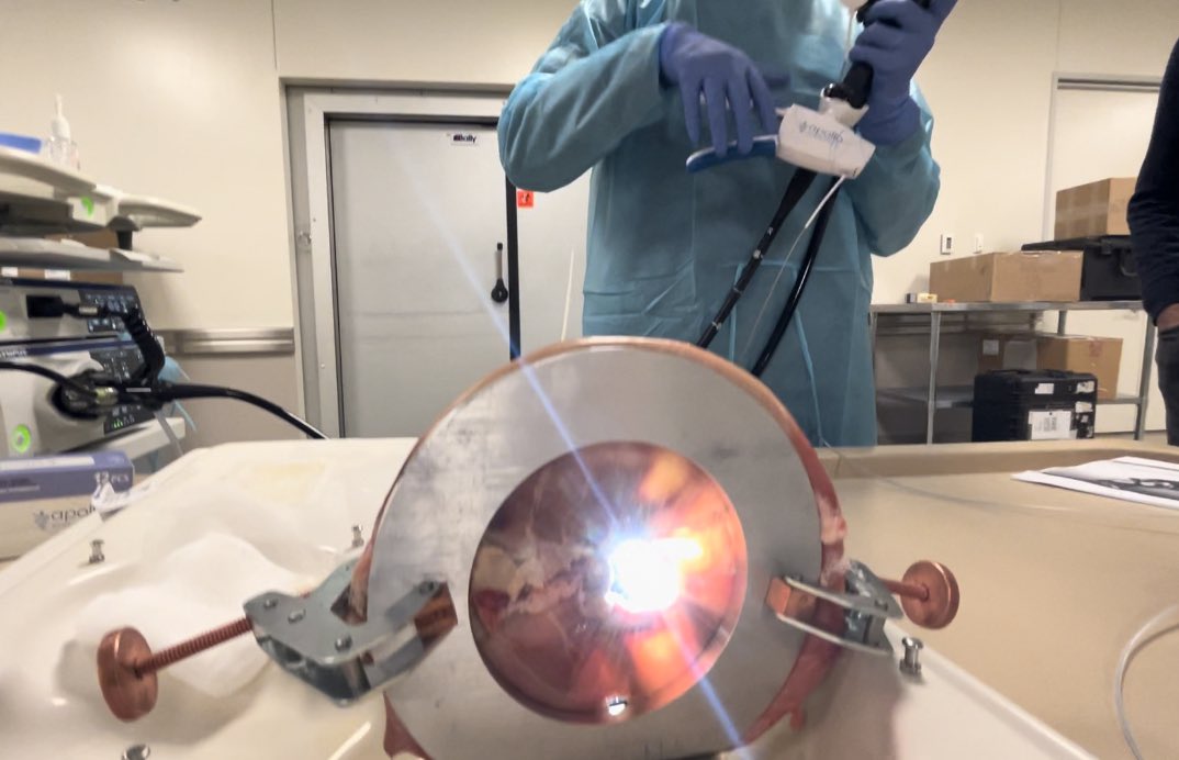 Manav Sharma (@manavsharma_md) on Twitter photo Congratulations @APOLLO_ENDO for organizing a fantastic Inaugural Endobariatric training course. Big thanks to course faculty/mentors <a href="/ChrisChapmanMD/">Christopher Chapman</a> <a href="/drhalimcharbel/">Dr Halim Charbel</a> Dr. Christopher Gostout, Dr. Robert Snow. Congratulations @APOLLO_ENDO for organizing a fantastic Inaugural Endobariatric training course. Big thanks to course faculty/mentors <a href="/ChrisChapmanMD/">Christopher Chapman</a> <a href="/drhalimcharbel/">Dr Halim Charbel</a> Dr. Christopher Gostout, Dr. Robert Snow.