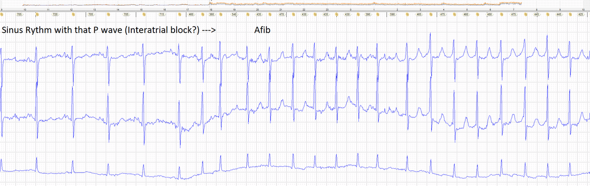 Lucas Moura tweet media
