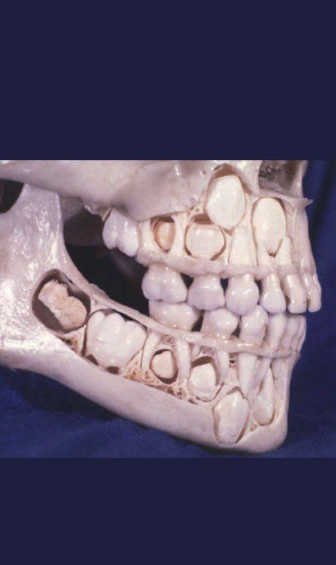 Ned Stephenson tweet media