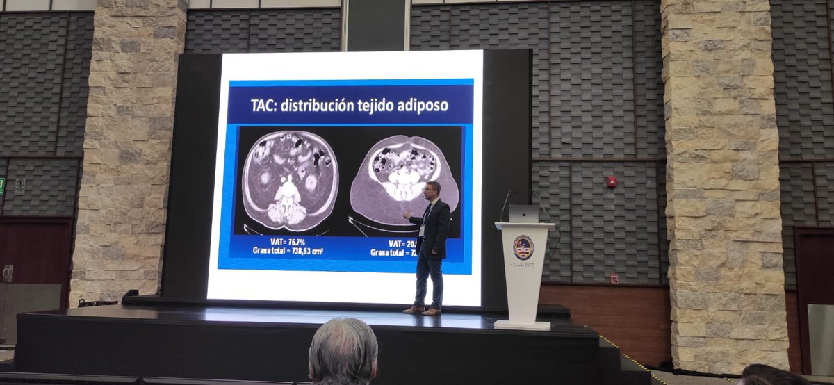 Sumergidos en las ponencias… cuando ya no te basta contarlo y tenés que vivir la experiencia <a href="/elopezgavito/">Elena Lopez Gavito</a> <a href="/Some4SurgeryIT1/">@Some4SurgeryITeam</a> <a href="/PipeCabreraV/">Dr Luis Felipe Cabrera Vargas MD FACS</a> <a href="/juliomayol/">Julio Mayol</a> <a href="/jdmmc1/">juan david martinez</a> <a href="/MIGUELMAGDALEN1/">MIGUEL.MAGDALENO.G</a> <a href="/RicardoRGlz/">HerniaDude</a> <a href="/herniacntercdmx/">Hernia Center Dr Olliver Núñez</a> <a href="/AecPared/">Seccion Pared AEC</a> <a href="/RNCsantander/">Dieter Morales #yosoydelclinico</a> <a href="/cjGomez22/">Carlos Gómez</a> <a href="/rafagdiazgobbo/">Rafael Díaz Del Gobbo</a> <a href="/bmquesada/">Matias Quesada</a>