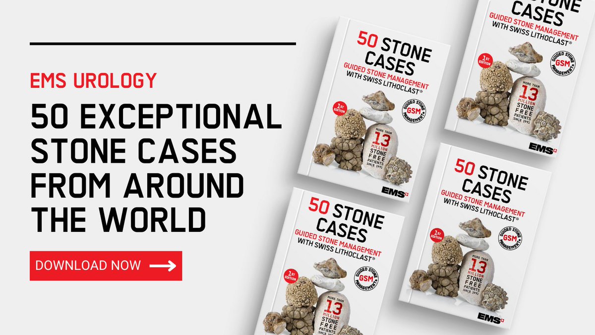 EMSUrology's tweet photo. 👉 Have you already downloaded our new e-book on "50 Exceptional Stone Cases from around the World" yet? 

The most excellent specialists worldwide have contributed by sharing their most exceptional stone removals. 🙌

Download it now ➡ https://t.co/IV9GpLjl6o https://t.co/mKbwKZ36mx
