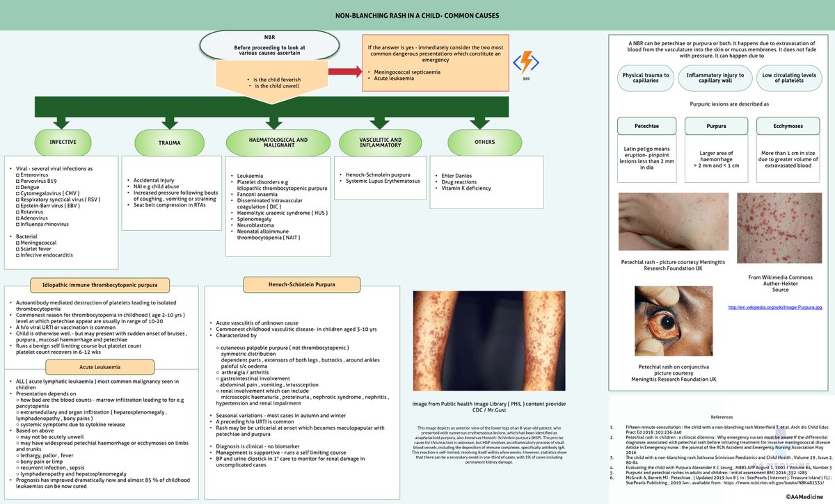 drromanpathak's tweet photo. Source: A4 Medicine
Child with a non-blanching rash #medicine https://t.co/Dwcr7B8l1R