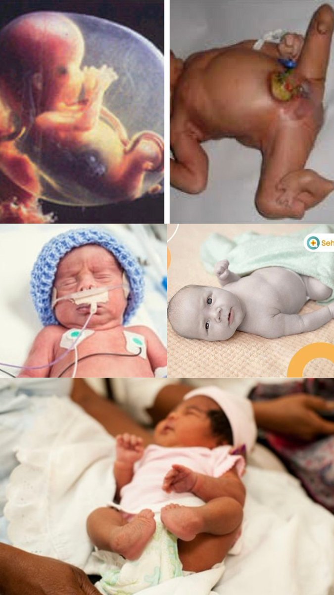 Ibu hamil jangan makan 10 jenis ubat dalam senarai di bawah ini.

Ubat-ubat ini sangat bahaya untuk baby dan boleh mengakibatkan kecacatan &amp; keguguran.

RT &amp; bookmark untuk rujukan ya.