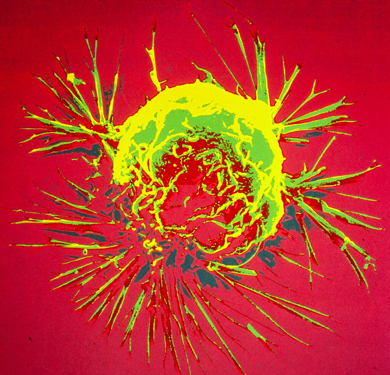 Breast Cancer Cell #science via <a href="/nih/">NIH</a>