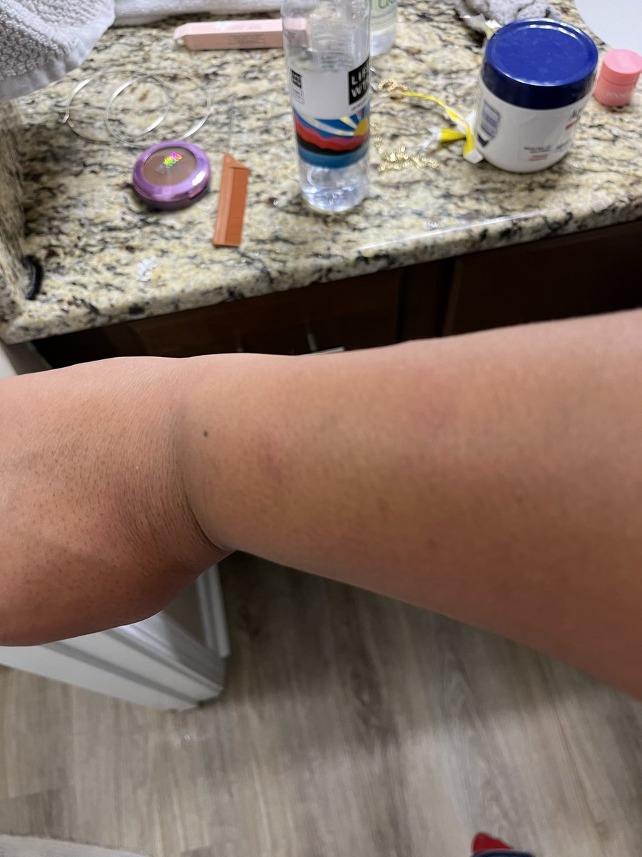 kkyrsteynn's tweet image. Refund. Our stay has been canceled and they are not willing to pay for a hotel or a new Airbnb. We have to be out in an hour with nowhere to go. Maybe this tweet will get to the right people since they think it’s okay to drag their feet and are willing to leave us stranded.