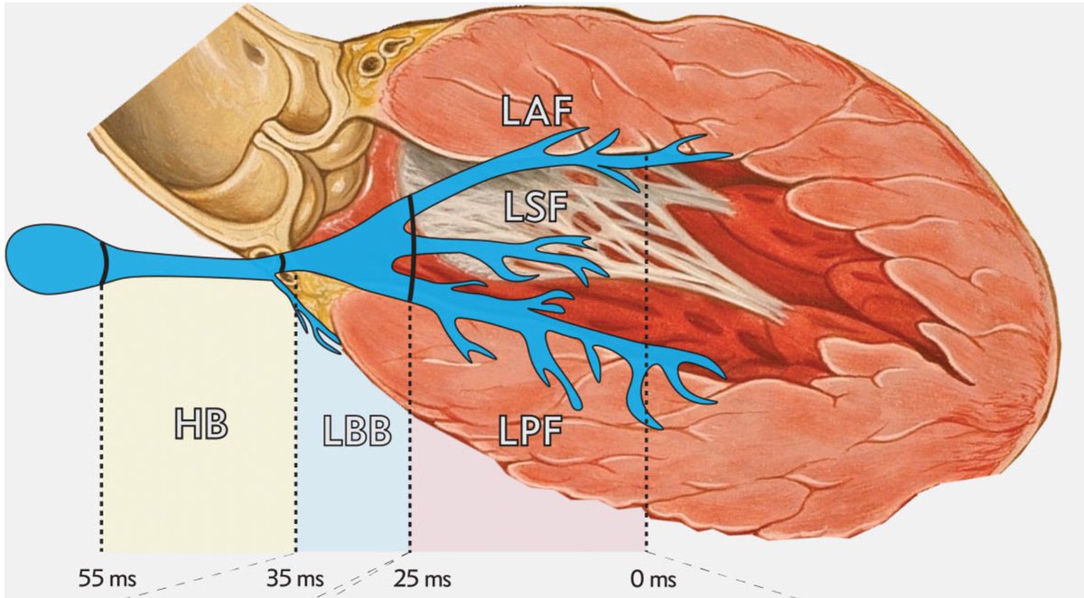 pzhong2016's tweet photo. Cardiac conduction system anatomy and pacing https://t.co/jCwPQdFzP4