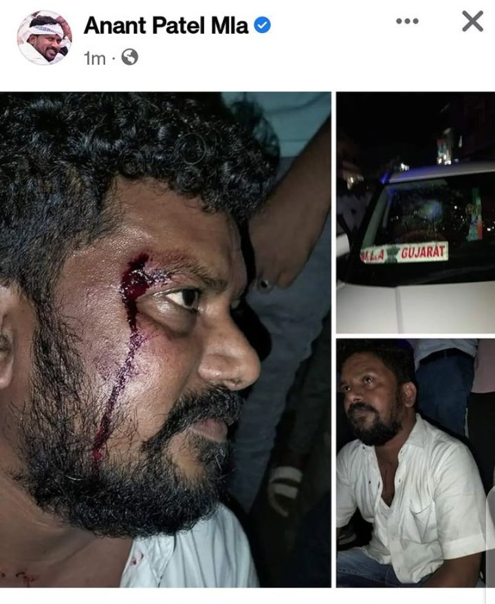 गांधी के गुजरात मे MLA भी सेफ नहीं है  ये गुंडे अचानक बढ़ कैसे गए ।

#Istand_With_MlaAnantPatel