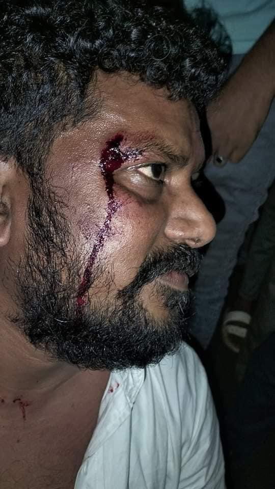 કોંગ્રેસ પક્ષના મારા સાથી ધારાસભ્ય  ભાઈ <a href="/AnantPatel1Mla/">Anant Patel MLA</a> ઉપર થયેલ હુમલાને હું સખત શબ્દોમાં વખોડી કાઢું છું અને માંગ કરું છું કે તમામ આરોપીઓ સામે તાત્કાલિક પગલાં ભરવામાં આવે.<a href="/CMOGuj/">CMO Gujarat</a> <a href="/dgpgujarat/">DGP Gujarat</a> <a href="/sanghaviharsh/">Harsh Sanghavi</a>