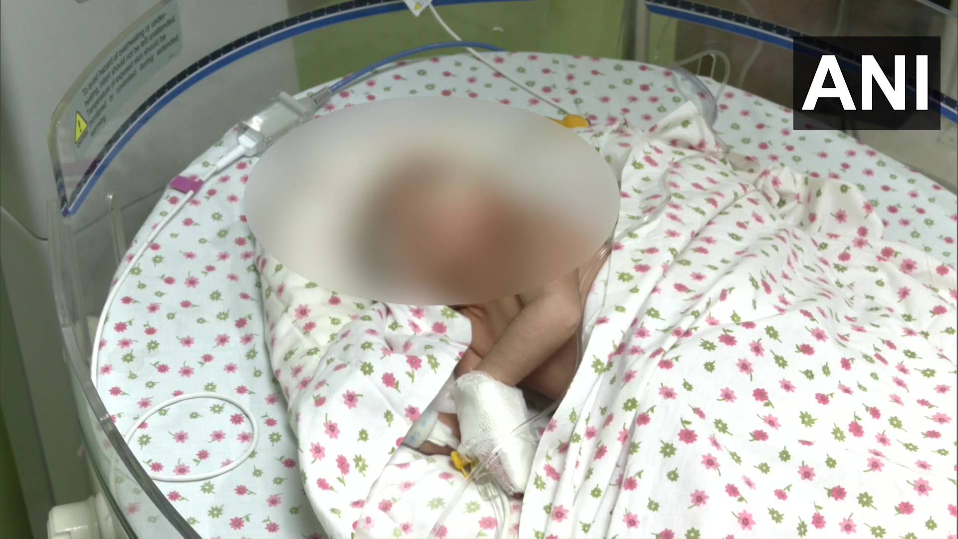 Newborn baby girl found in a garbage dump with umbilical cord