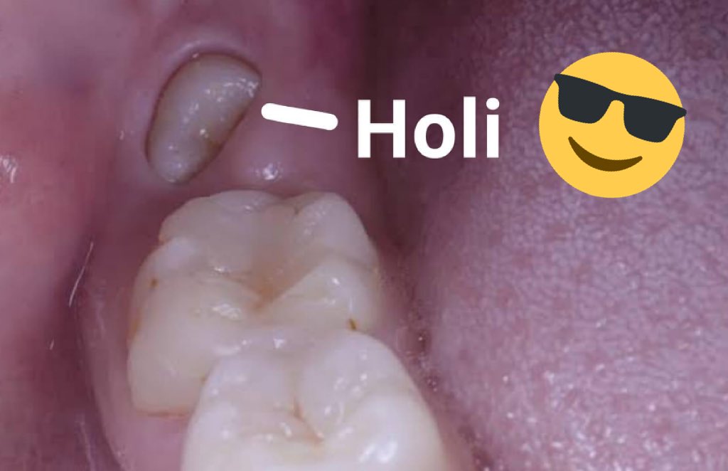 Only_Dental's tweet photo. Yo : por fin tengo la dentadura perfecta. 
La 🦷 del juicio : 👋 https://t.co/0IsWEcE5yz
