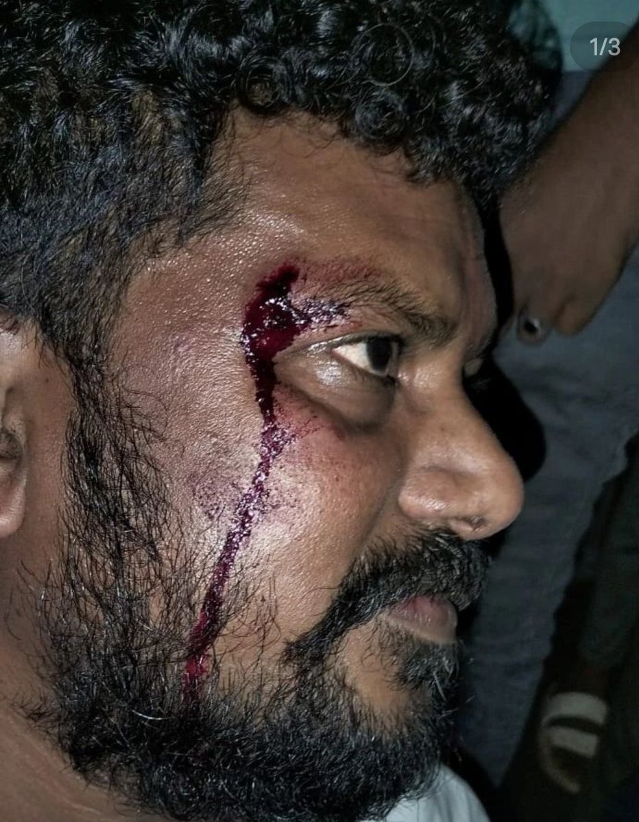 जिस राज्य में विधायक सुरक्षित नहीं है वहा आम आदमी कैसे सुरक्षित होगा।।
<a href="/GujaratPolice/">Gujarat Police</a> हमलखोरों को जल्द से पकड़े और उनको सजा दे ऐसी आशा है।
#Istand_With_MlaAnantPatel 
<a href="/DDNewsGujarati/">DD News Gujarati</a> 
<a href="/GujaratPolice/">Gujarat Police</a> 
<a href="/gujratsamachar/">Gujarat Samachar</a>