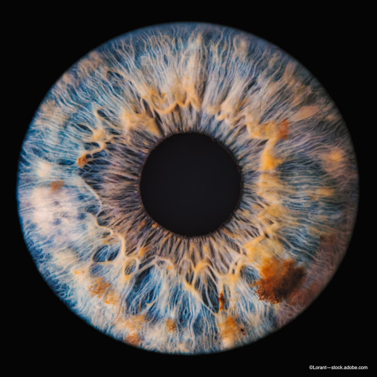 Ophthalmology Times Europe tweet media