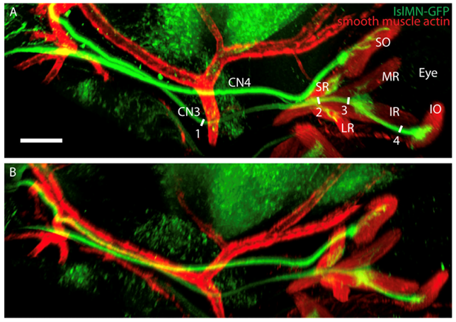 TheLens_oph's tweet photo. Let’s explore a developmental mouse model of infantile nystagmus in the current issue of @ARVOiovs! https://t.co/qnzPwVJLTM #Ophthalmology #ARVO #Nystagmus https://t.co/fVzNO3igJq