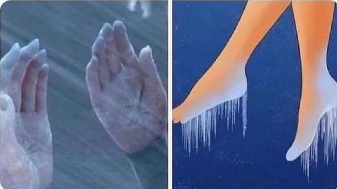 boohoo's tweet photo. my hands and feet 100% of the time https://t.co/utcC5j7MMj