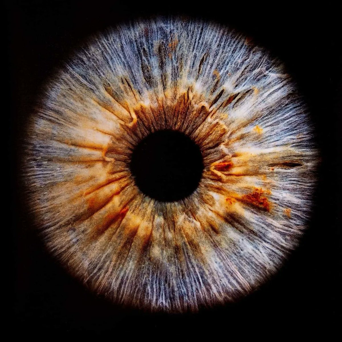 Devildogg1983's tweet photo. Got some amazeballs professional photos done of my eye from @_iris_photo
You can now see why I have very little vision from my bad eye.
#EyeSyndrome #eye #irisphoto #iris #ICE #Devildogg1983 #iridocornealendothelialsyndrome #Glaucoma #doublevision #halfblind https://t.co/Oomv3d9eCV