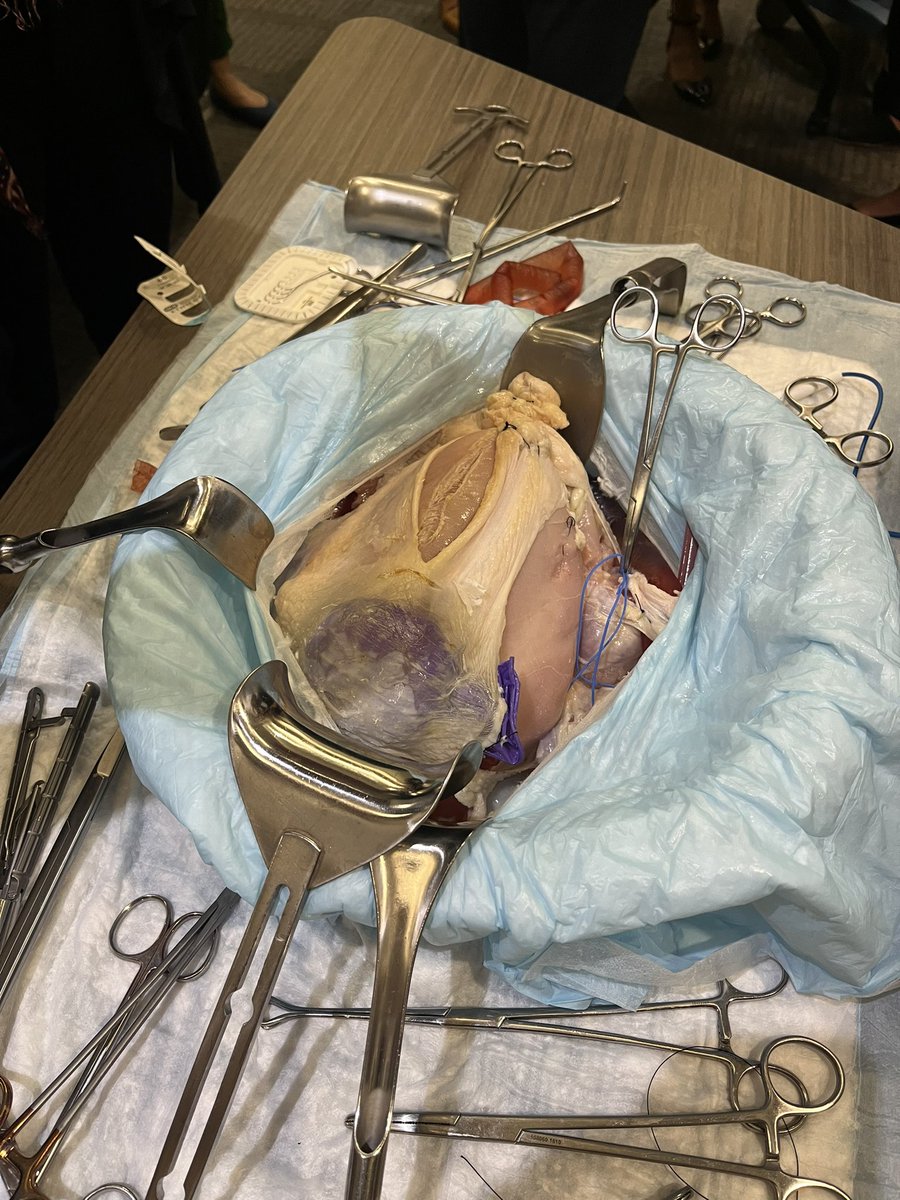 The new C-Hyst 🐓#accretaawareness   #PAS22