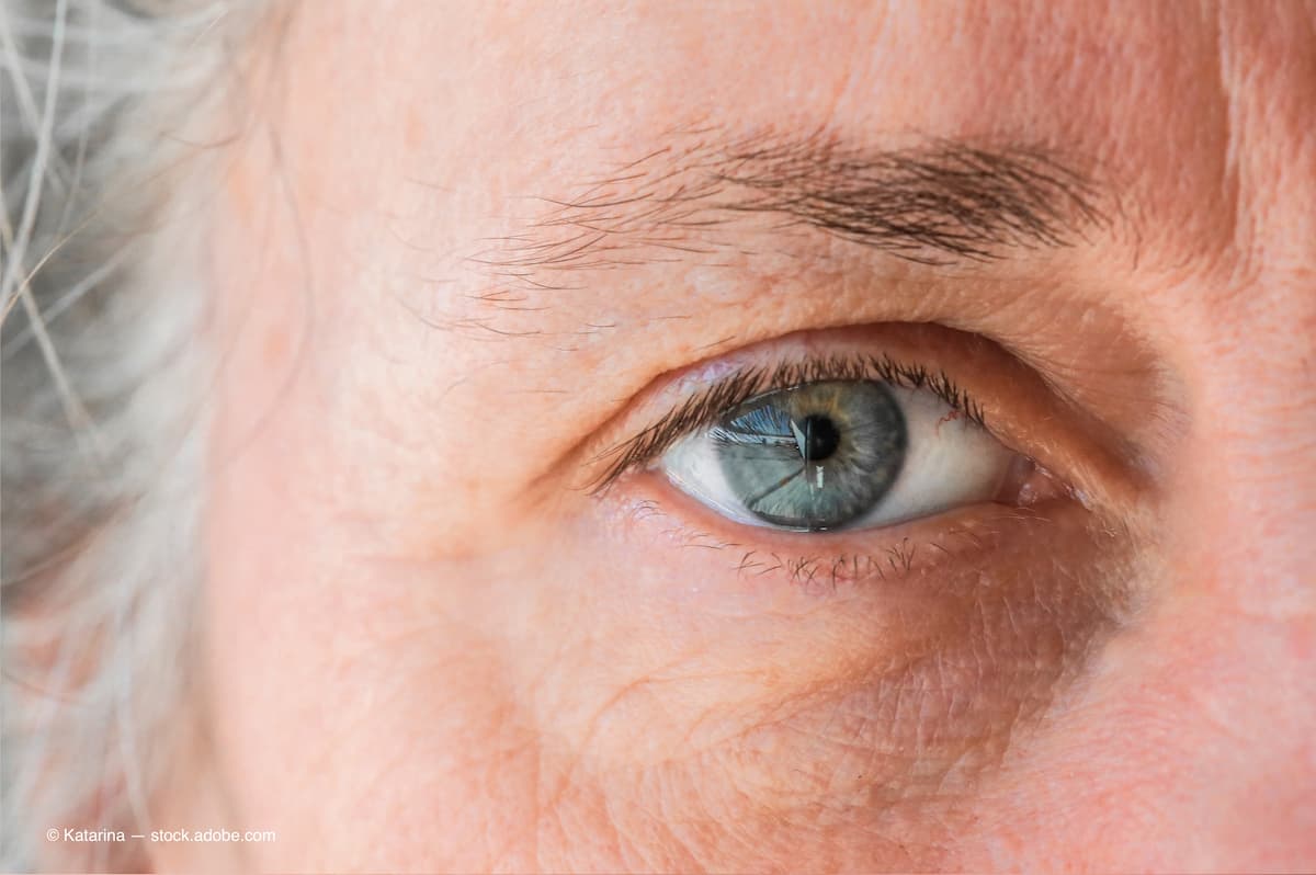OptometryTimes's tweet photo. The future holds a great deal in glaucoma drug therapy

More: https://t.co/4KT07JNqbh

#Optometry #VEW2022 #VEW22 https://t.co/VLdHt6Wxlv