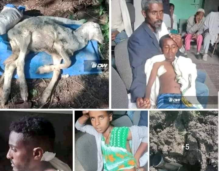 fdemiana's tweet photo. Why don't we feel humanity?The enemy of the Tigray ethnic group has attacked airplanes and non-pilots on civilians living in and around Shire town and the surrounding areas the latest attacks caused death and injuries More and more
#TigrayUnderAtack 
@SecBlinken @Antonio45815904 https://t.co/qEoZ6F9Liw