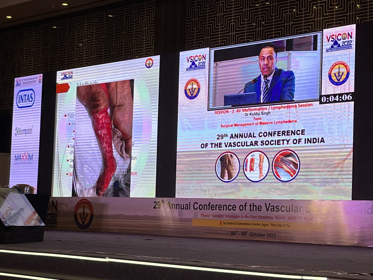TheVascularDoc's tweet photo. Had the pleasure to listen and learn from the surgeon extraordinaire @Kuldeep1926 about managing Massive lymphedema at VSICON 2022.#VSICON2022 #VSI 
#VSICON @Vascular_India #lymphedema #vascularsurgery
#surgery @VascularSVS
#medtwitter
@tapishsahu @vascularsrgn @SavlaniaAjay https://t.co/vSheg4Ejix