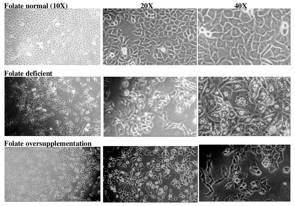 cancerscnews's tweet photo. In a recent @SciReports paper 📰 by @DrJyotdeep and colleagues, the effect of folic acid depletion and oversupplementation on #HepG2 cells was tested, including the effect on #CancerStemCell prevalence. 

#OpenAccess to their findings 👇 
https://t.co/eRipEy2pBt https://t.co/SsKSLos1zh