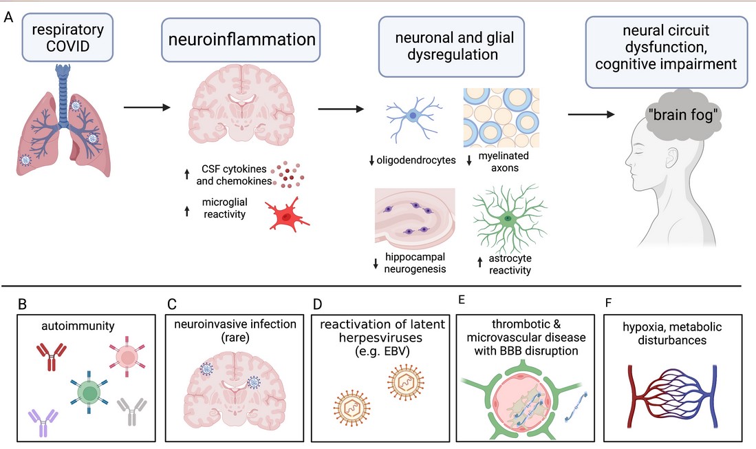 More on how #LongCovid affects the brain from <a href="/VirusesImmunity/">Prof. Akiko Iwasaki</a> &amp; <a href="/michelle_monje/">Michelle Monje🎗️ 🟦</a> 

♦️6 ways: Neuroinflammation, infection, autoimmune response, reactivation of latent herpesviruses, microvascular/thrombotic disease and pulmonary/multiorgan dysfunction. 
cell.com/neuron/fulltex…