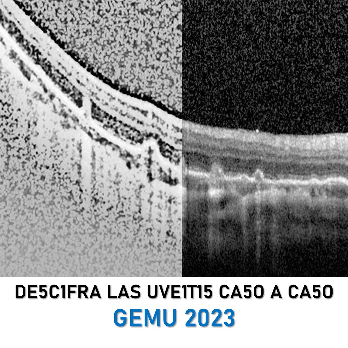 GemuSedu's tweet photo. Un año más, Madrid acogerá la 35 Edición del GEMU repleta de casos clínicos y trabajos de investigación en uveítis, retina y mácula. En el siguiente link puedes enviar tu abstract para la reunión. 

TE ESPERAMOS!!

https://t.co/H53enb5RfR https://t.co/gNMrwDW2FT