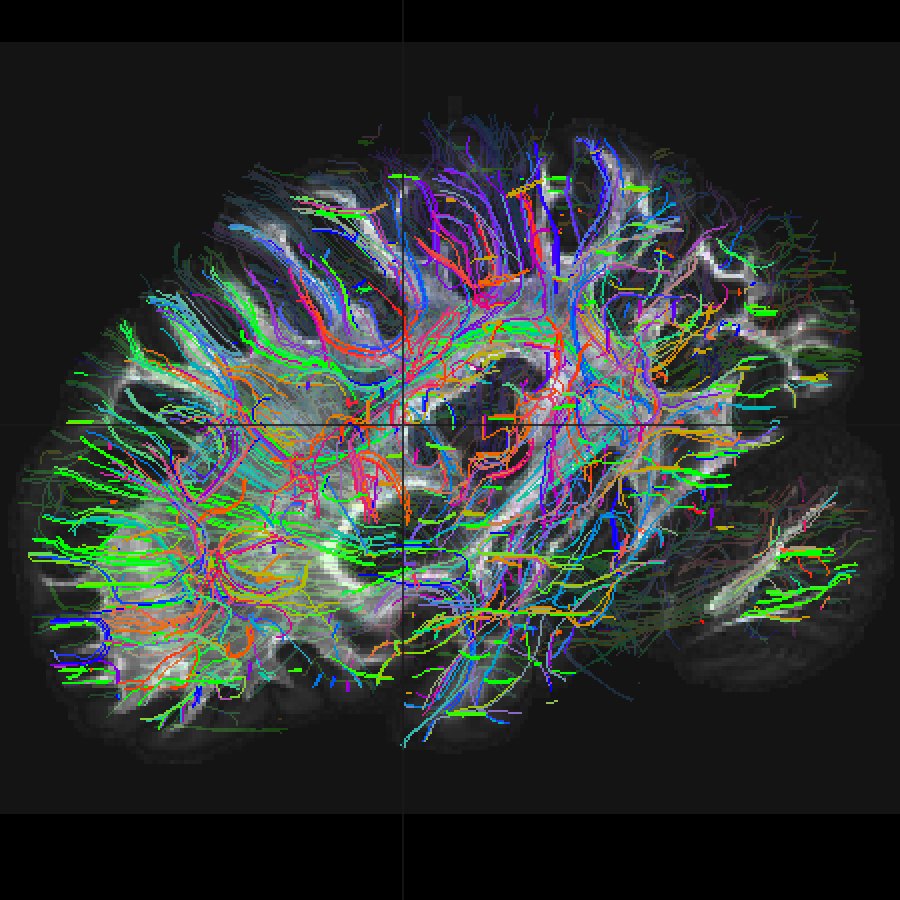 nastasiayendiki's tweet photo. Hello, tract! Quite possibly the first tractogram in the universe created entirely in @JuliaLanguage https://t.co/8DiSB6VZym