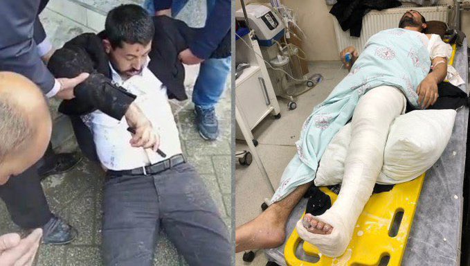 Halkın oylarıyla Meclis'e giren HDP Milletvekili Habip Eksik polis tarafından darp edildi, ayağı kırıldı. Halkın iradesine boyun eğdiremezsiniz! Kürt halkının, Habip Eksik'in yanındayız.