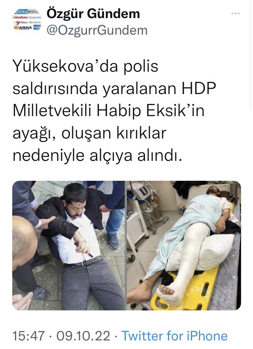 Polis devletinin başı “Kırın” talimatı verirse, polisi de her bacağı kırar böyle..
“#HDP’ye sahip çıkar gibi görünmeyelim” diye suspus olan muhalefet partileri, ancak kendi bacakları kırılınca anlayacak, bu suskunluğun bedelini…
#HabibEksik