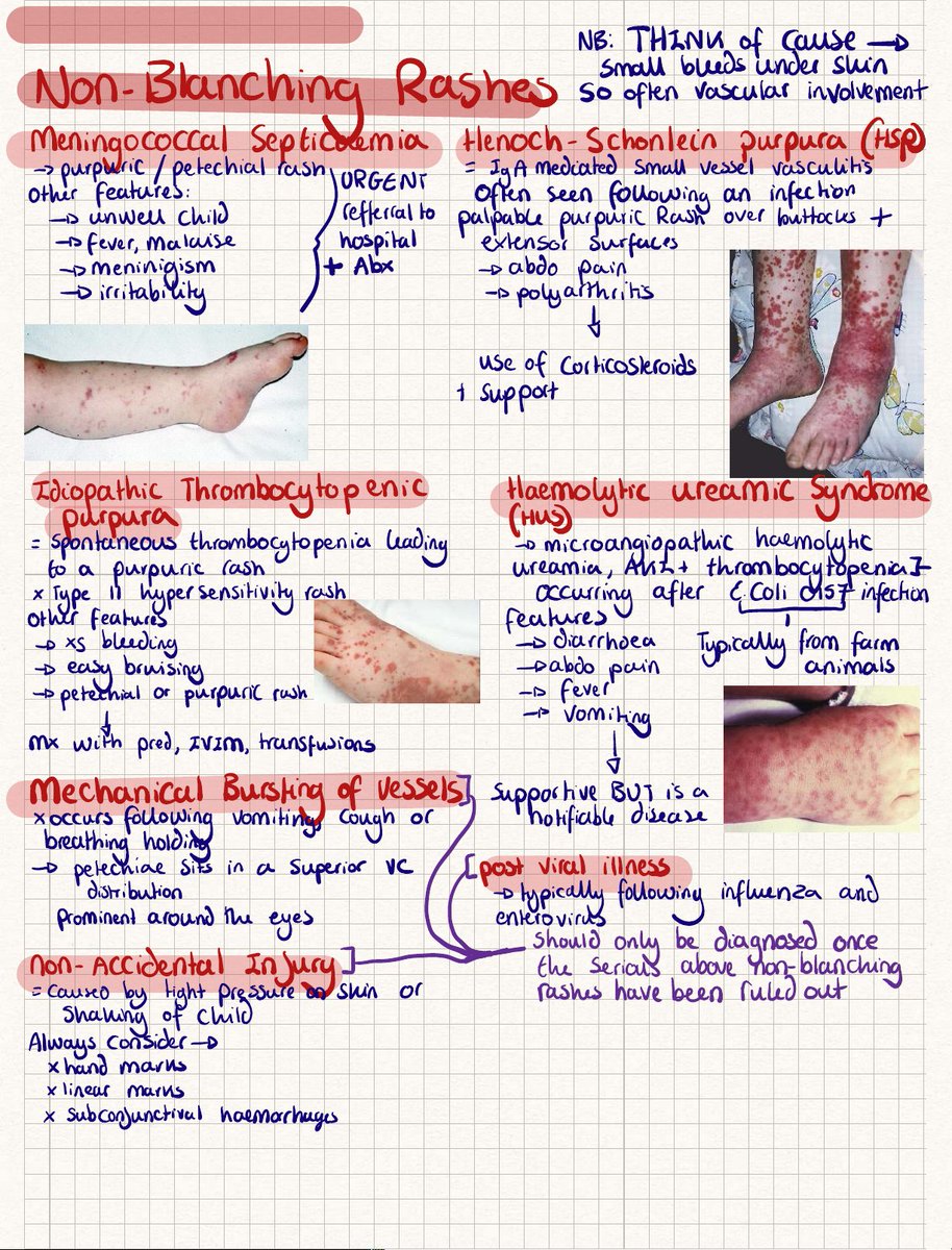 drromanpathak's tweet photo. Pediatric rashes #medicine
Source: https://t.co/nDVdco40X3 https://t.co/cMTNfaoWyG