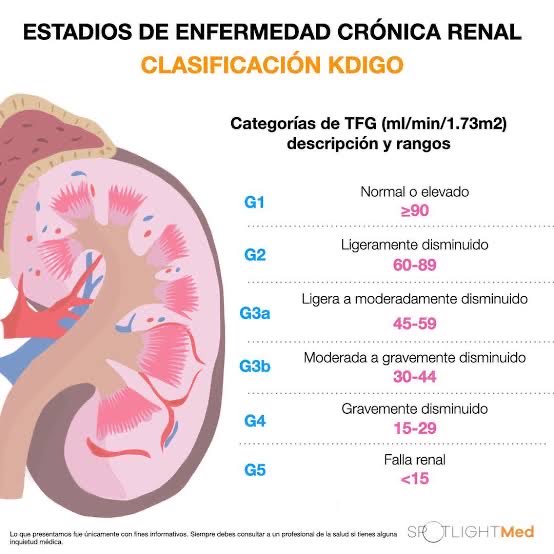leslie_anco's tweet photo. Estadios de insuficiencia renal crónica 
.
.
.

#ENARM #ENARM2022 #Mir2023 #2MIR23 #2MIR24 #Enam #residentadomedico2022 #facmed #flashcard https://t.co/xp0ZPcVu6y
