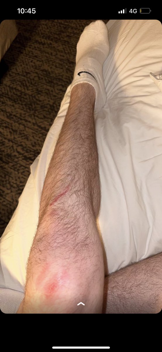 remanotfound's tweet photo. DREAM POSTED THIS ON SNAPCHAT!!!
I hope he’s ok https://t.co/VhpyC5uuy1