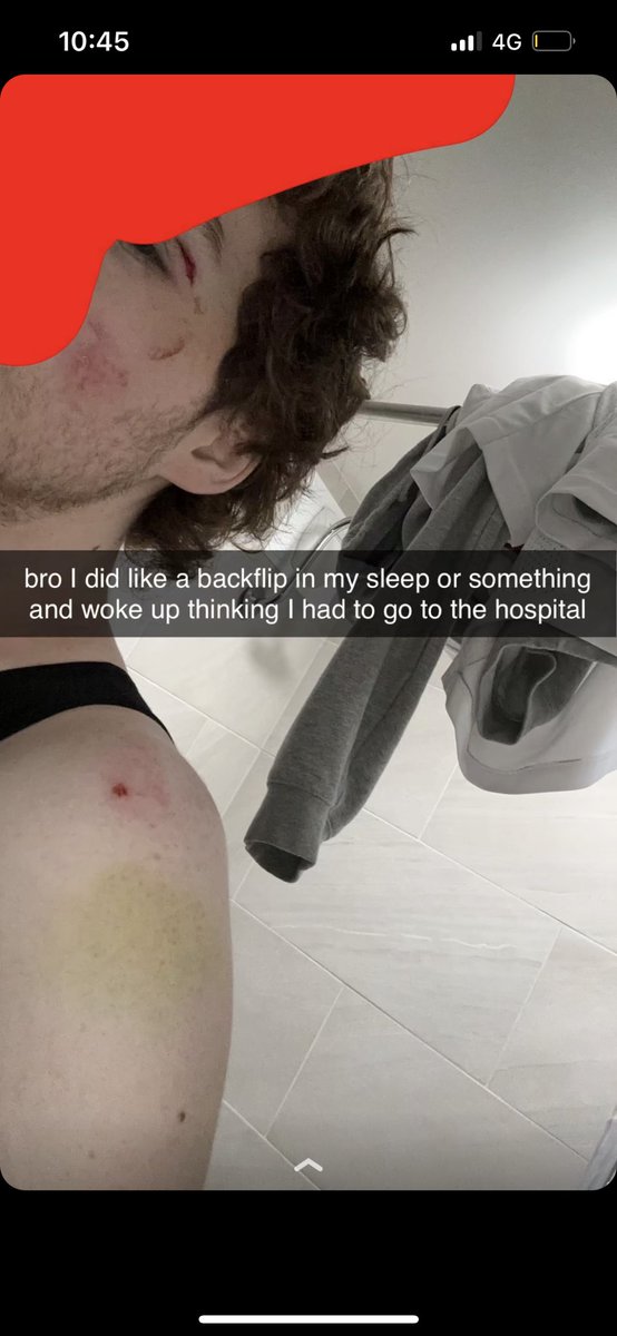 remanotfound's tweet photo. DREAM POSTED THIS ON SNAPCHAT!!!
I hope he’s ok https://t.co/VhpyC5uuy1