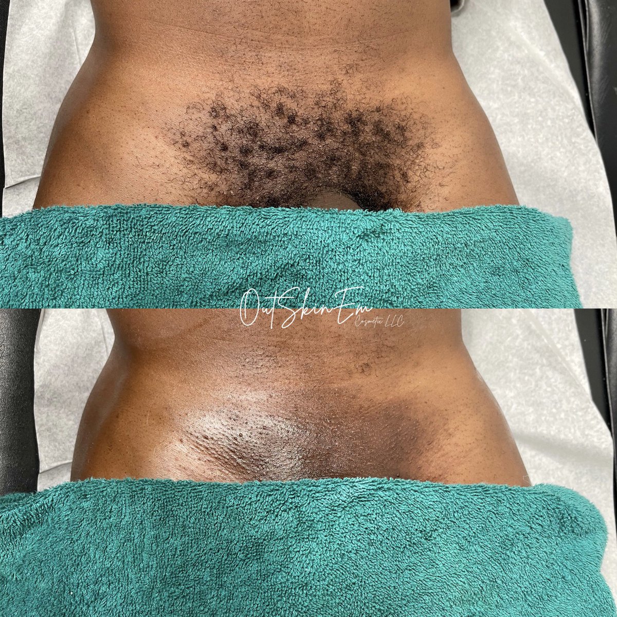 therealttc_'s tweet photo. @_knbent Penacial Treatment🧖🏽‍♂️
(manzilian wax + facial)✨🍆 https://t.co/quljnS23i4