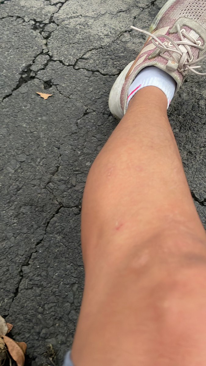 lybra_ali's tweet photo. @UCS_GCDMX,  día de ayer fui atacada por 6 perros  rodando por una ladera solo tengo contusiones por la caída pero al  apoyarme mi esposo fue mordido y atacado  por los mismos perros, donde puedo hacer mi denuncia https://t.co/RLRF0AhPEq