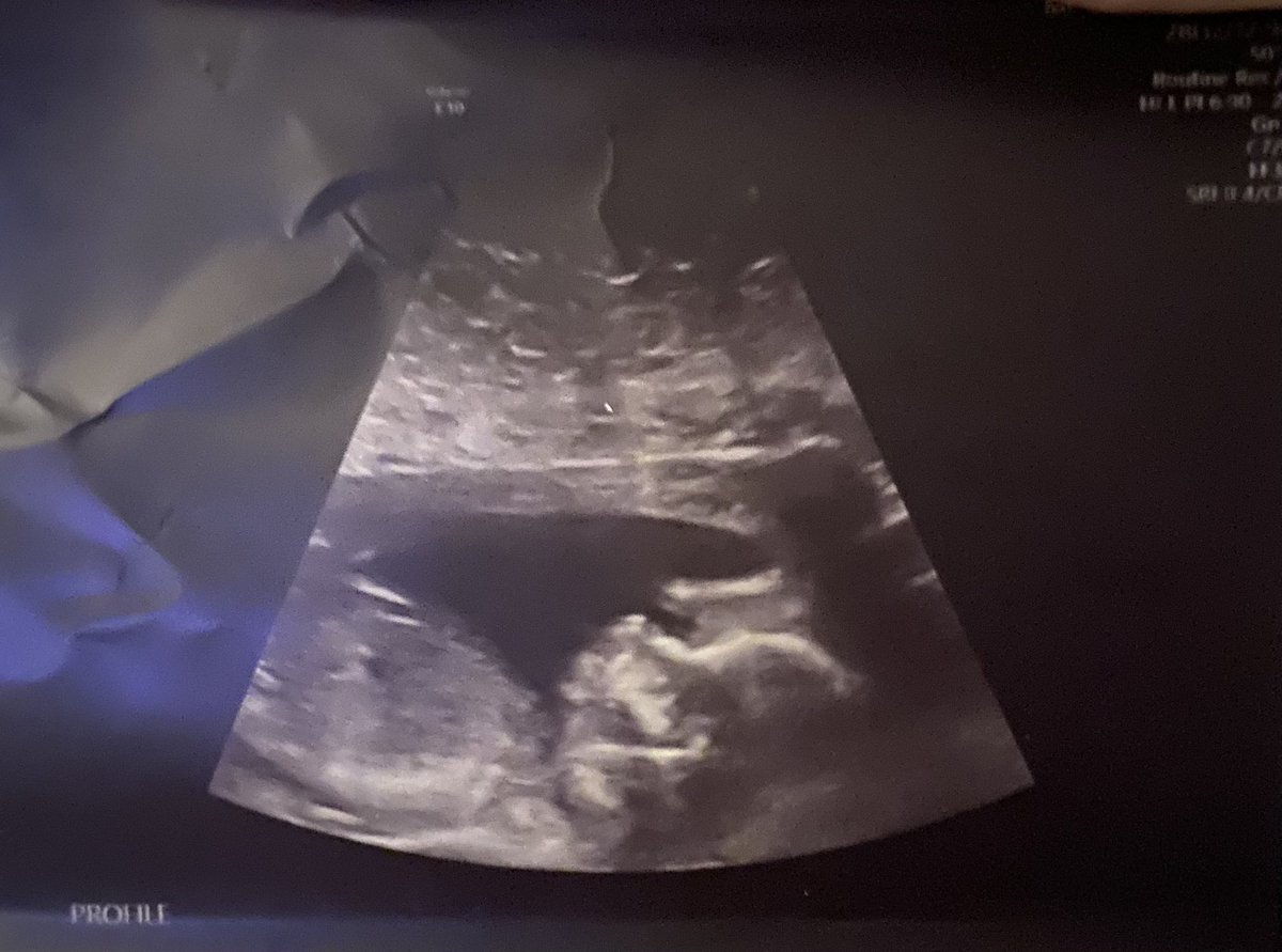 Another year of being thankful for the best co-workers and students to spend my days with. A little extra thankful this year for their constant patience with me and for always going the extra mile as I continue to grow this little human ❤️. They have all been so great!