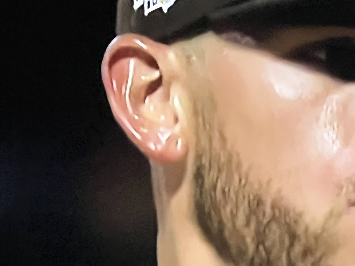 torrej15's tweet photo. @AndrewBaydala Joe Musgrove ears https://t.co/f0CzkV1OuW