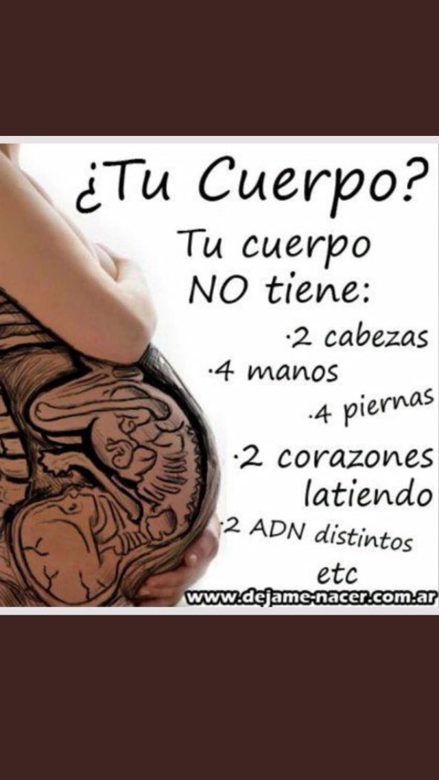 GaryField4's tweet photo. #RNacional Quieren cruc1ficar a @carreragonzalo por decir algo obvio frente a un personaje neutro que defiende SU “derecho” al Aborto Libre Esto es lo grave, no la verdad de DeLa Carrera. 
O sea quitarle la vida a un ser inocente inventando una violacion es mucho más grave. https://t.co/FjqO9rdP1m
