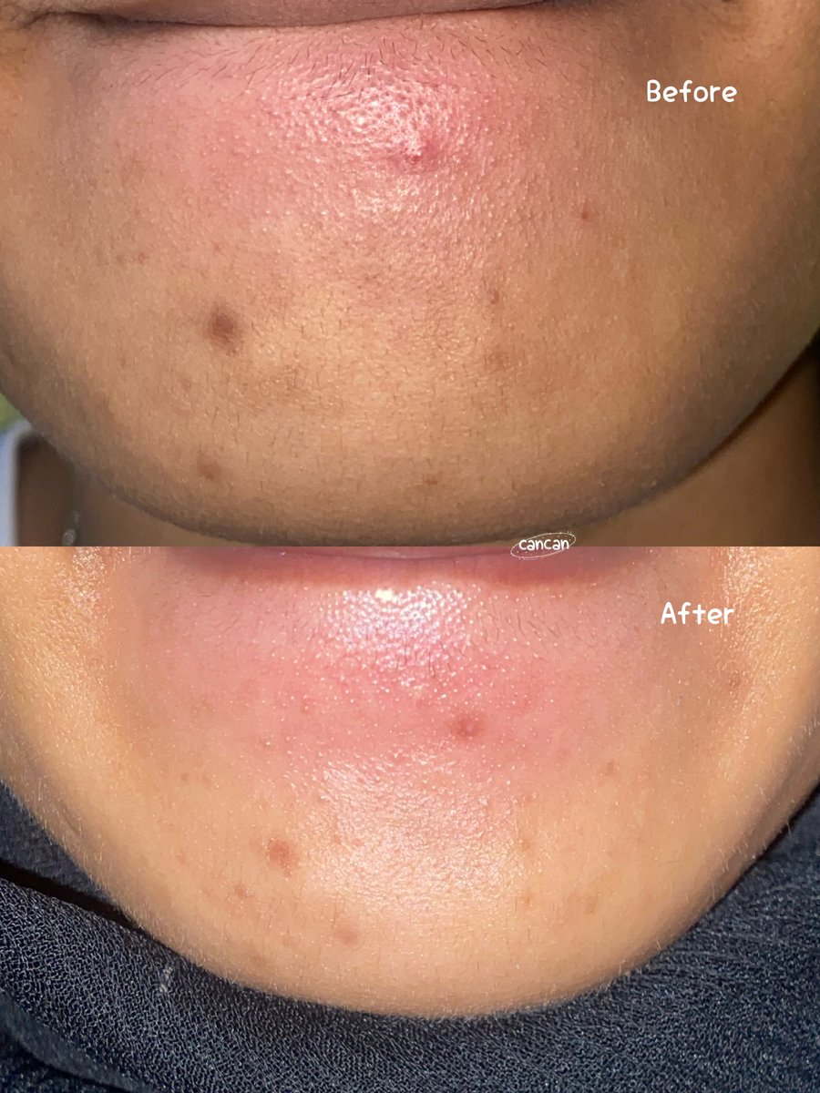 cancanᰔᩚᵕ̈ tweet media