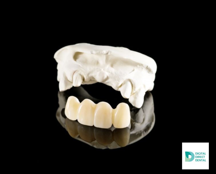digitdirectdent's tweet photo. Zirconia crowns provide superior esthetics, 100% biocompatibility, extraordinary strength, and are manufactured with CAD/CAM technology for a precision fit.#zirconia #dentallab #dentaltech #dentallablife #dentaltechnician #cadcam https://t.co/4v34KfapgW