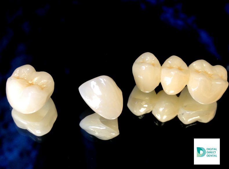 digitdirectdent's tweet photo. Zirconia crowns provide superior esthetics, 100% biocompatibility, extraordinary strength, and are manufactured with CAD/CAM technology for a precision fit.#zirconia #dentallab #dentaltech #dentallablife #dentaltechnician #cadcam https://t.co/4v34KfapgW