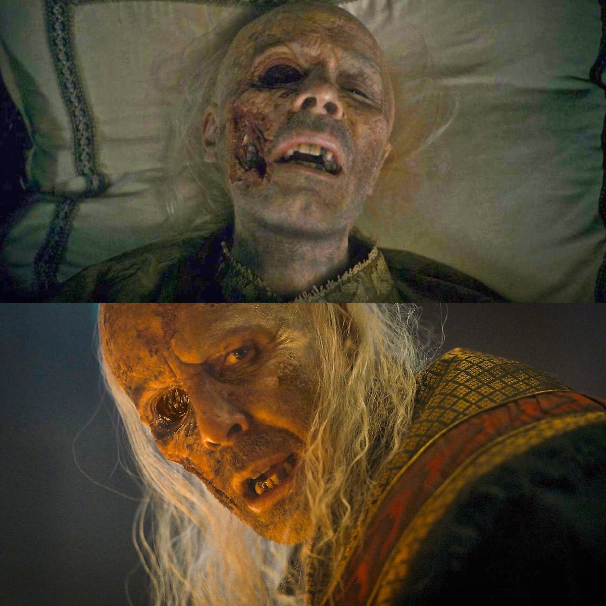 HOTDBr's tweet photo. Além da atuação incrível do Paddy Considine, precisamos exaltar demais a equipe de efeitos visuais e maquiagem de #HouseOfTheDragon 

Que trabalho absurdo! 👏 https://t.co/d8IfdBUEhW