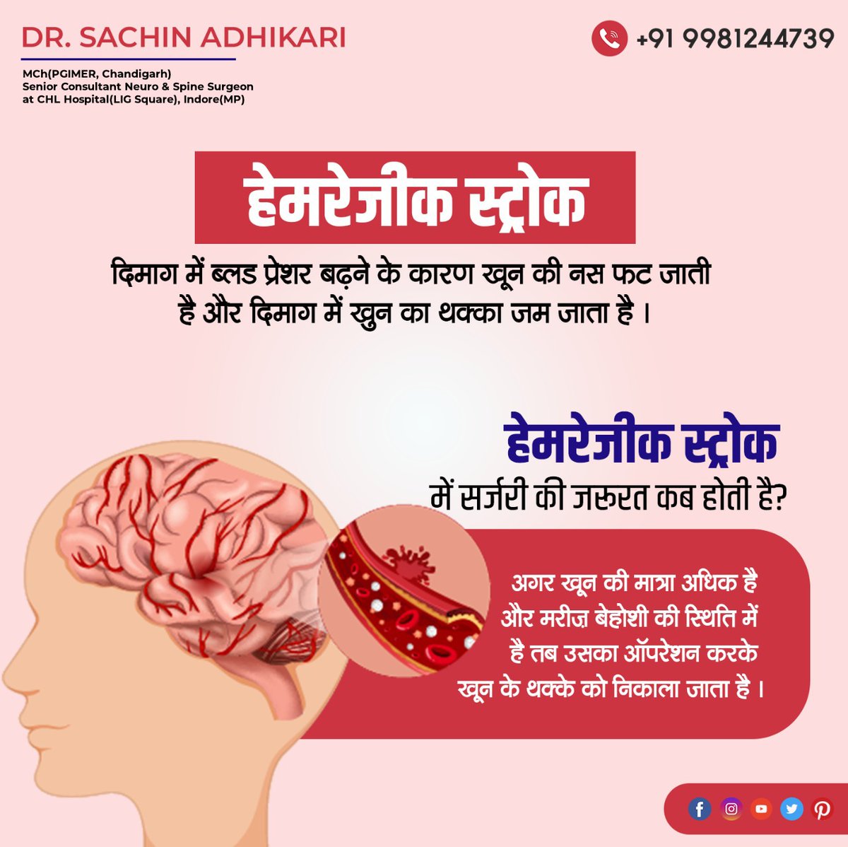 SACHINA40585950's tweet photo. ब्रेन स्ट्रोक के इलाज के बारे में अधिक जानकारी के लिए आज ही संपर्क करे
डॉ. सचिन अधिकारी
+91 9981244739
#drsachin #DrSachinAdhikari #chlhospitalindore #neurologist #neuro #brain #brainstroke #stroke #strokeprevention #brainhealth #braincare #braintime #timeofcare #signsofstroke https://t.co/OIFmPVCkf2