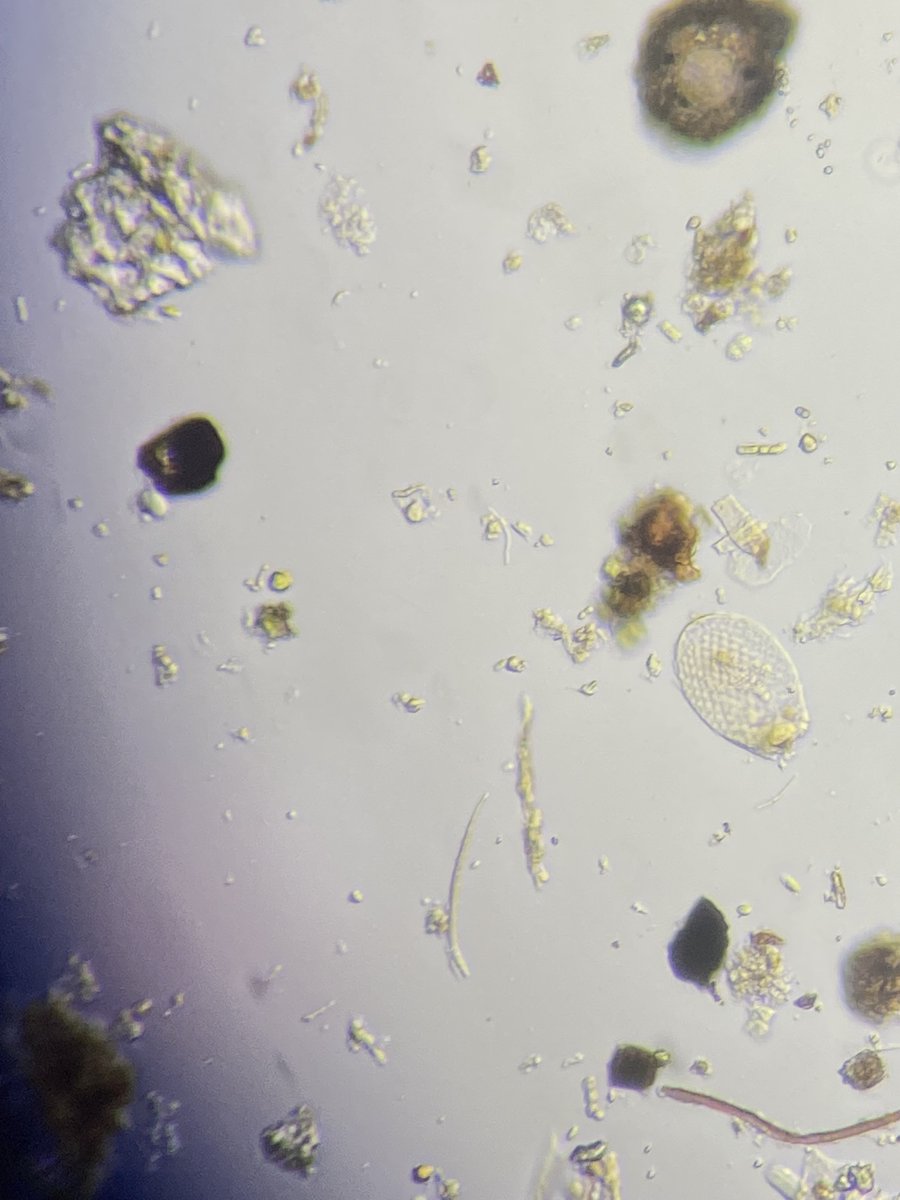 NematologyW's tweet photo. Alex, @schwelmo and Robbert teaching @WUR Ecological Aspects of Biointeractions.
#Microscopy seeing #rotifera, #tardigrades, #protists followed by #sequencing- cool work guys!😎 https://t.co/751PGkQuUZ